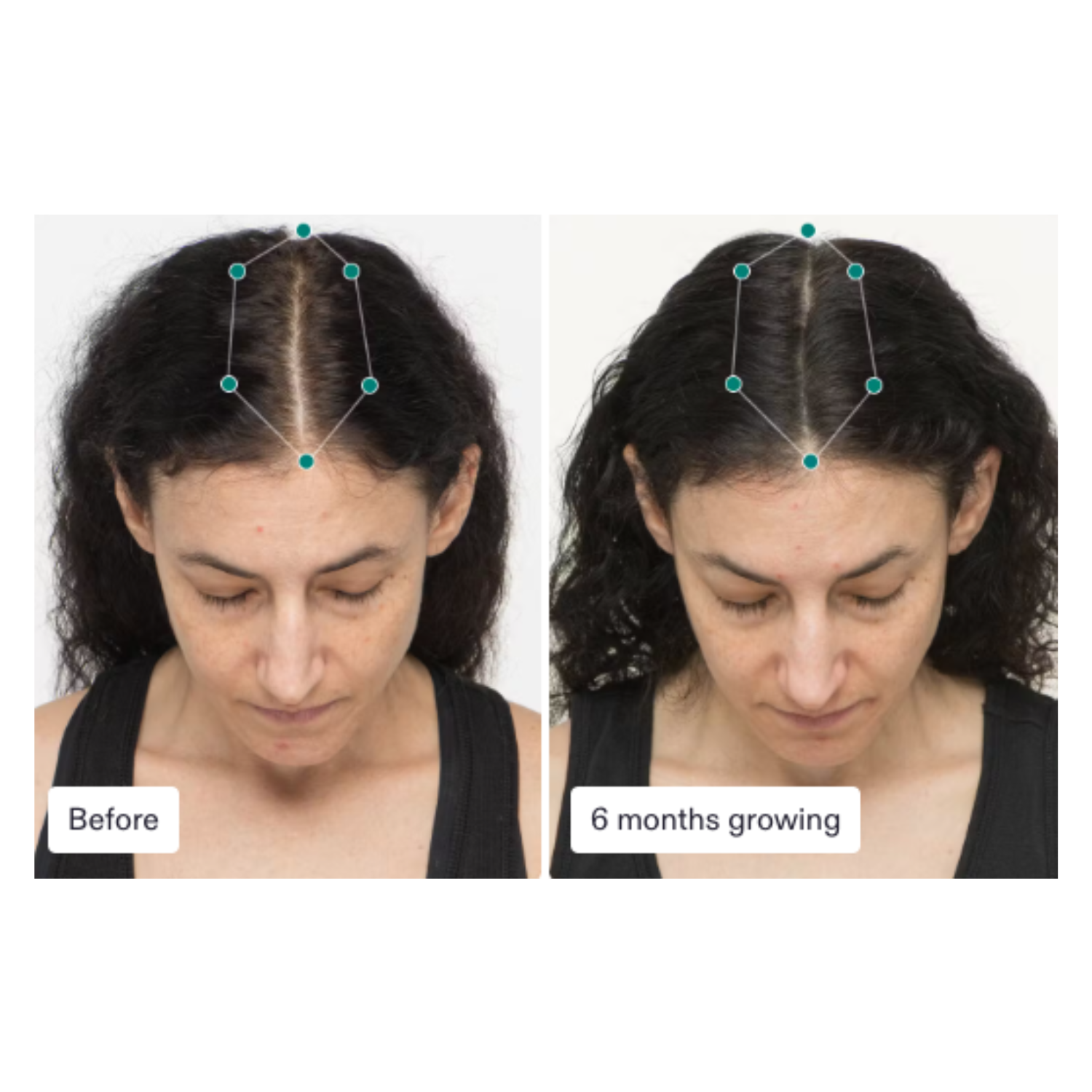 Nutrafol: Women Hair Growth Nutraceutical (3 month supply)