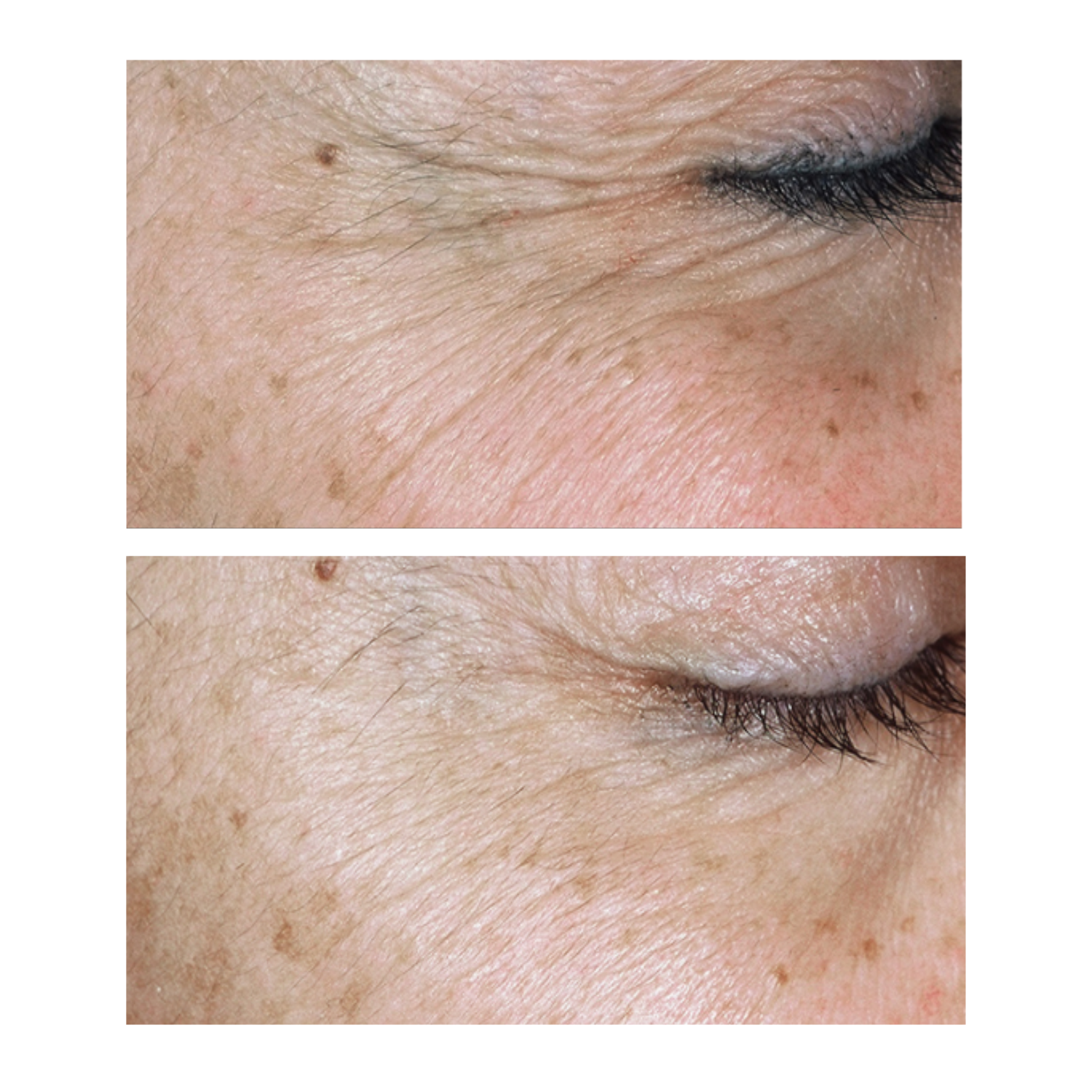 SkinMedica: TNS Recovery Complex