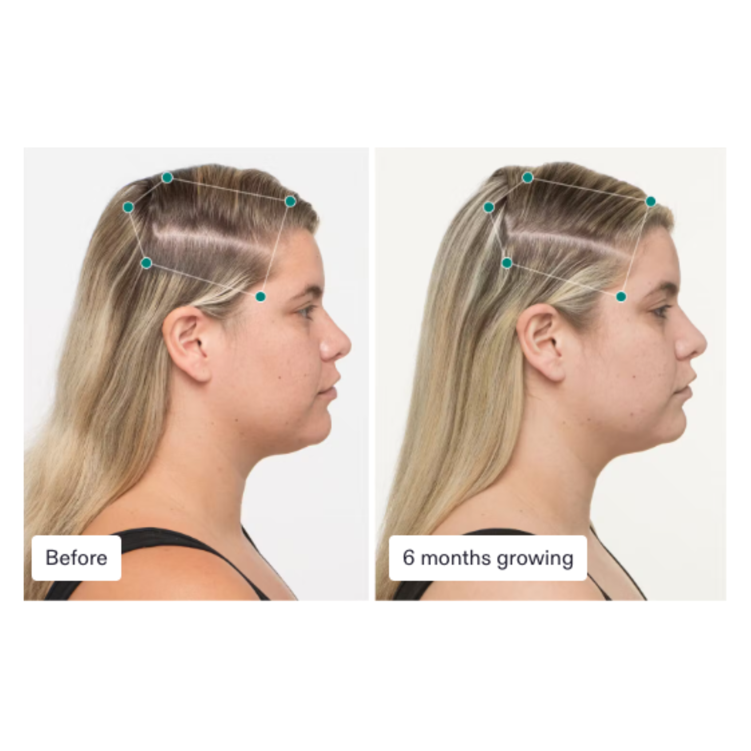 Nutrafol: Women Hair Growth Nutraceutical (3 month supply)