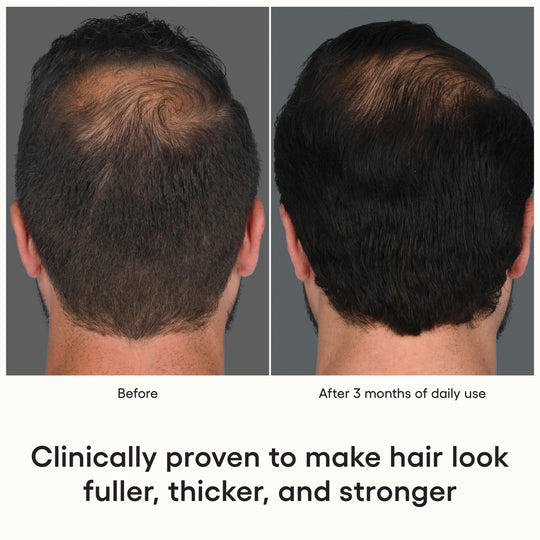 Plated Skin Science: Hair Serum